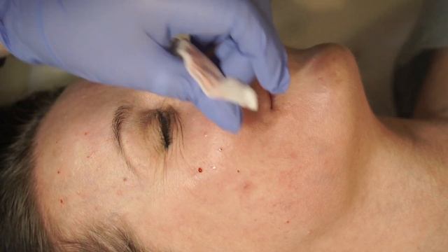 Platinum + PDRN Active периорбита, лицо и шея. Цой Ю. В.