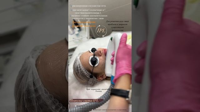 IPL импульс света смотреть онлайн