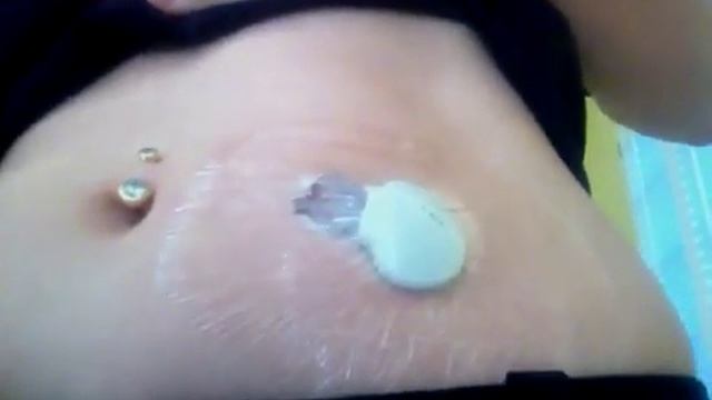 I pro 2 continuous glucose monitoring, coming to The Bahamas смотреть онлайн