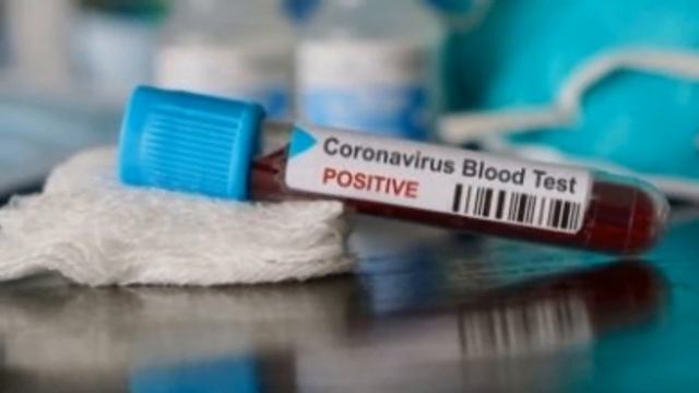 Vaksin obat anti virus corona smoga ditemukan Indonesia, UI IPB Menristek: Jambu biji Madu, covid 1 смотреть онлайн