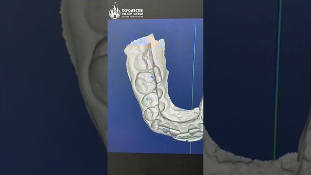 Анализ 3D цефалометрической цифровой диагностки смотреть онлайн