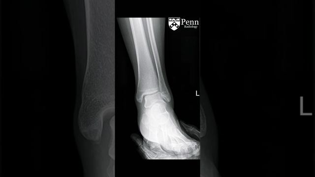Radiology in clinical practice 22 Amr Saadawy смотреть онлайн