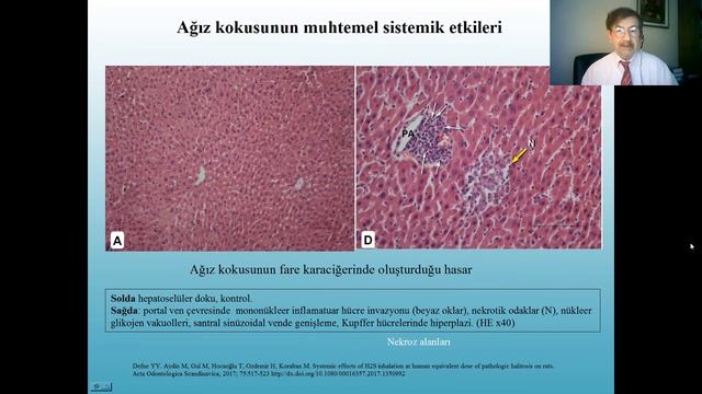 Ağız kokusu - dahiliye hekimlerine veb konferans -2022 Kasım смотреть онлайн