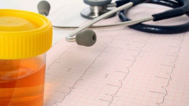 Несептің өзгеруі қандай да бір аурудың белгісі болып табылады….(2024) смотреть онлайн
