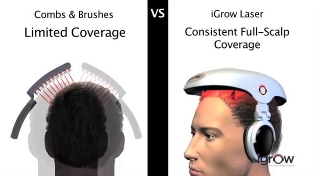 iGrow laser helmet смотреть онлайн