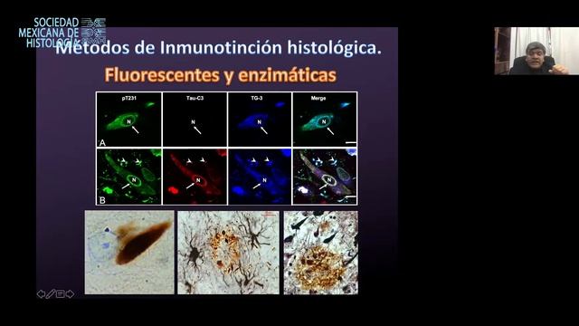 Taller de inmunohistoquimica смотреть онлайн