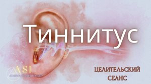Тиннитус