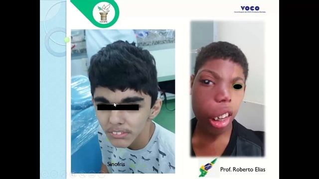 Prof. Roberto Elías: Síndromes de cabeza y cuello. смотреть онлайн
