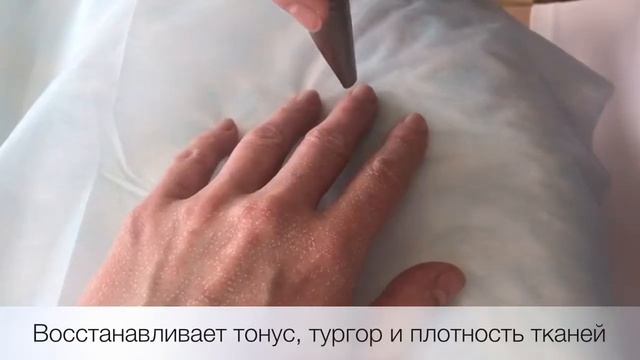 Омоложение рук Fotona смотреть онлайн