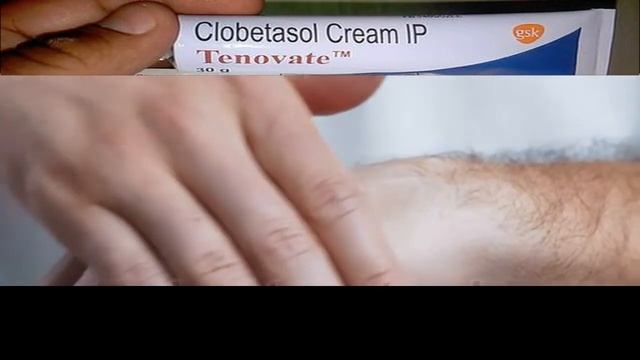 What are the side effects of clobetasol смотреть онлайн