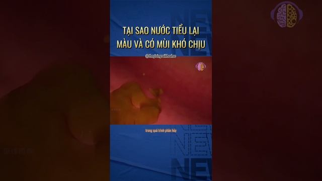 sao nước tiểu lại có mùi смотреть онлайн