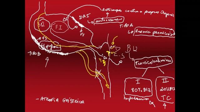 Aula 7 - Anemias Macrocciticas Megaloblastica e não Megaloblástica смотреть онлайн
