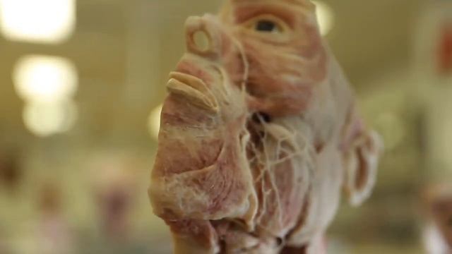 OSPE: Scalp, face, muscle of mastication смотреть онлайн