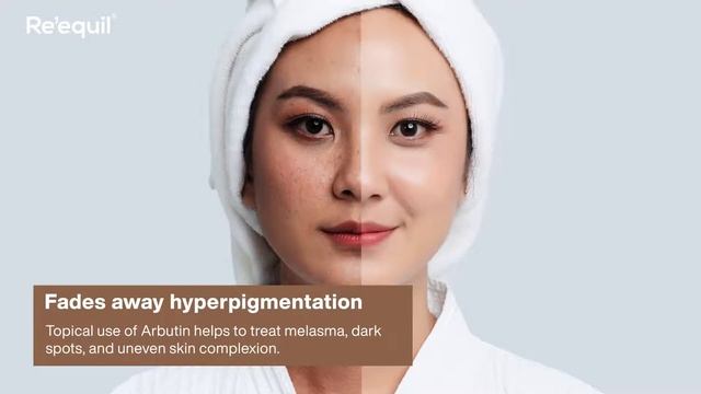 Top Benefits Of Arbutin For Skin смотреть онлайн