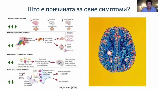 Психијатриски симптоми кај мултипла склероза смотреть онлайн