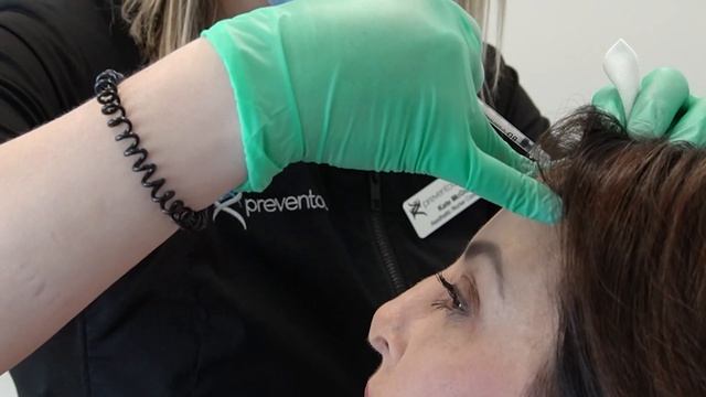 Botulinum Toxin Treatment at Preventous - Before and After смотреть онлайн