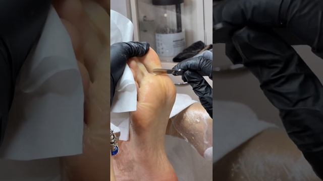 Педикюр, коТорый лечит?! Шок-контент!!!! смотреть онлайн