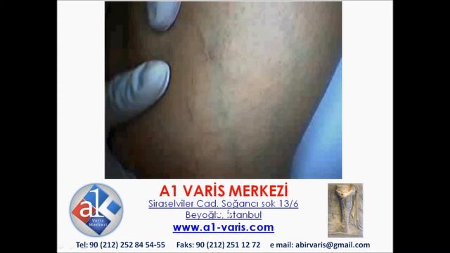 A1 VARİS MERKEZİ смотреть онлайн
