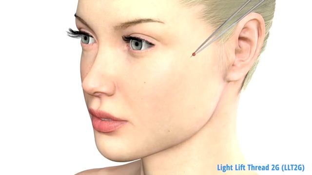 APTOS Light Lift Thread 2G смотреть онлайн