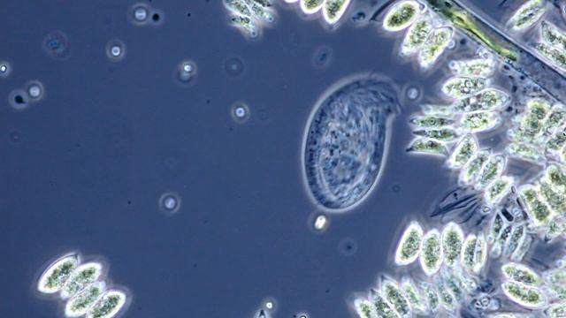 Wimpertierchen (Chilodonella uncinata) смотреть онлайн