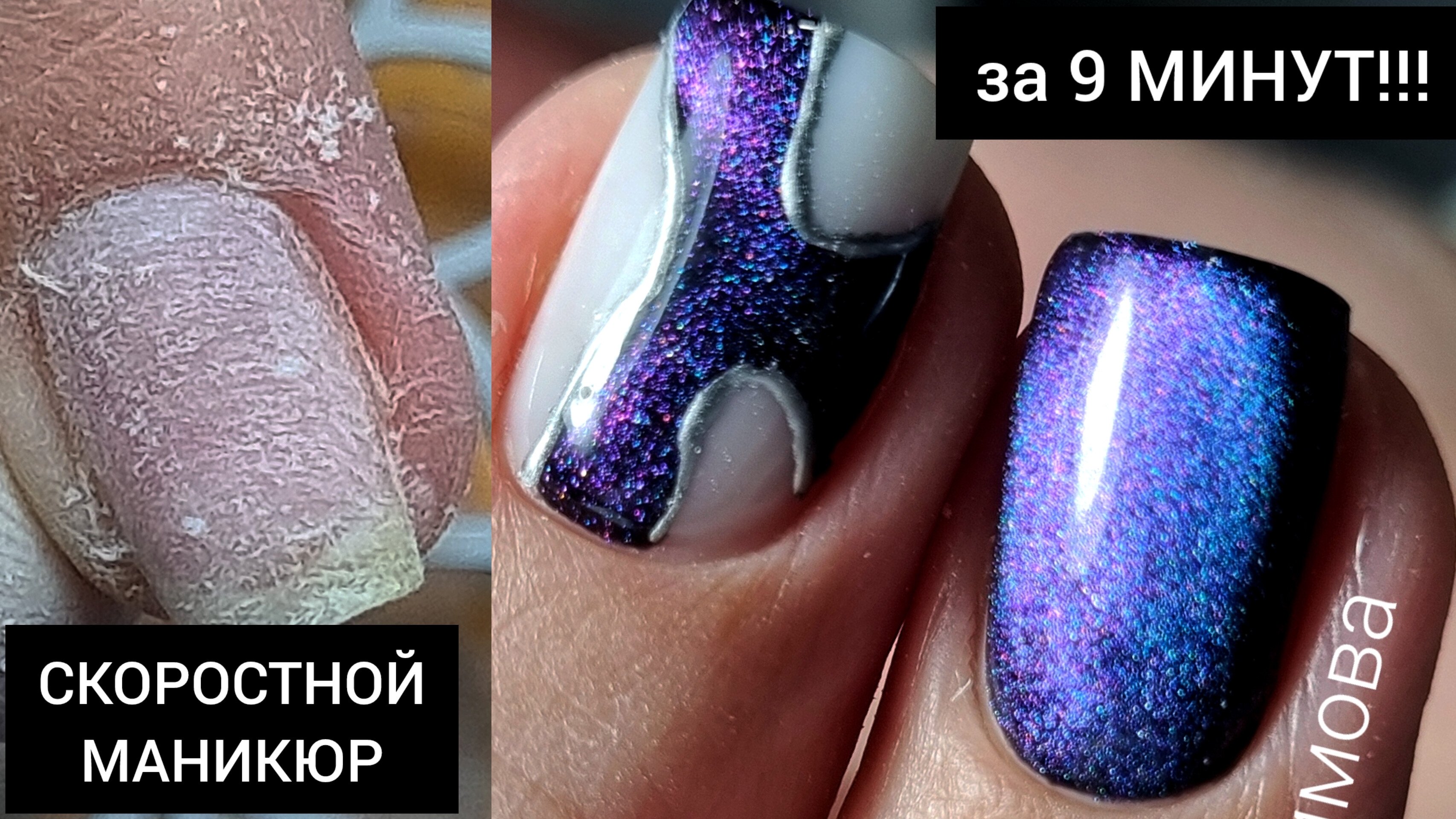 ТРАВМА и ОТСЛОЙКА