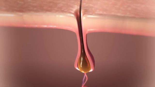 Как работает аппарат для лазерной эпиляции: принцип действия смотреть онлайн