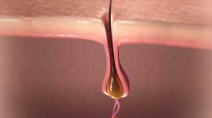 Как работает аппарат для лазерной эпиляции: принцип действия