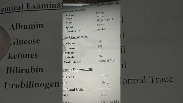 كيفية قراءة تحليل البول urine analysis смотреть онлайн