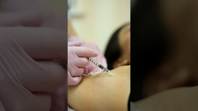 Лечение гипергидроза ботулотоксином смотреть онлайн
