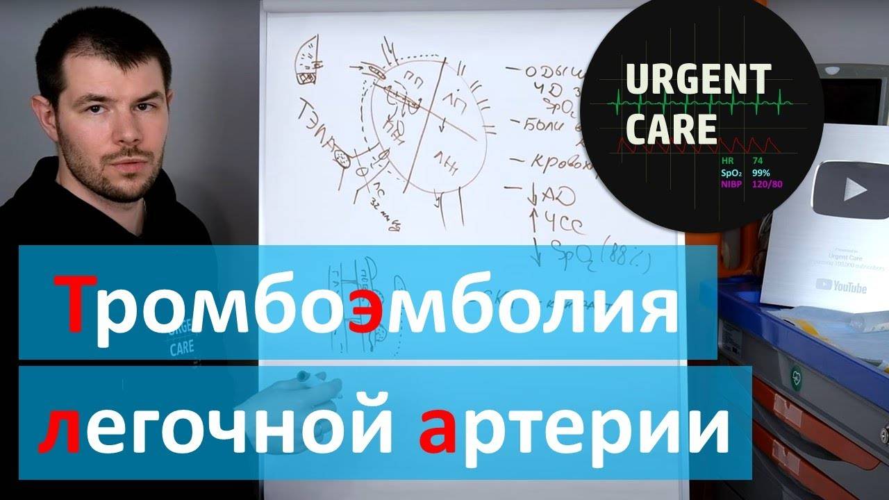 Все о ТЭЛА - тромбоэмболия легочной артерии смотреть онлайн