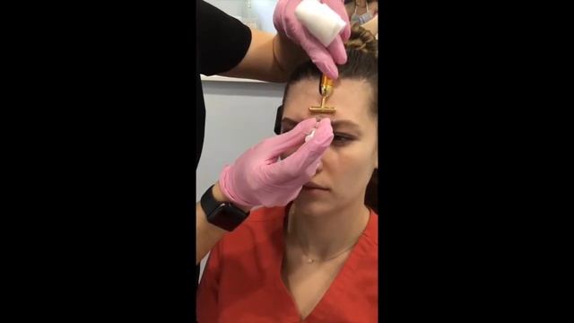 Botox Used to Reduce Facial Wrinkles смотреть онлайн
