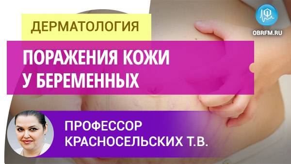 Профессор Красносельских Т.В.: Поражения кожи у беременных смотреть онлайн