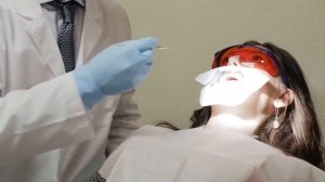 Система отбеливания  Beyond Polus Advanced