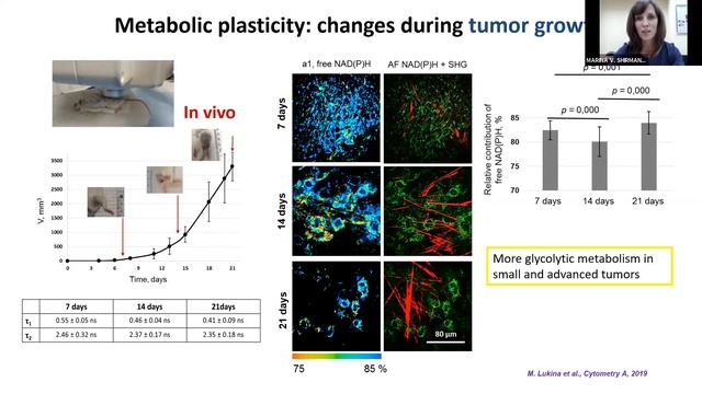 Insights into tumor biology with FLIM/PLIM смотреть онлайн