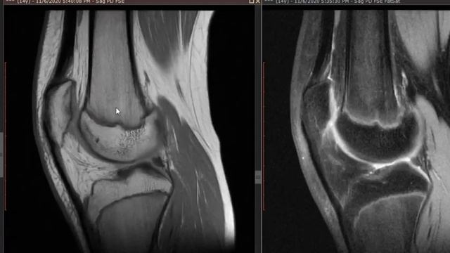 Radiology in clinical practice 23 Dr. Amr Saadawy смотреть онлайн