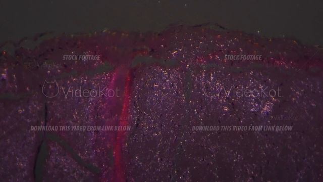 Dense connective tissue with tendon in longitudinal section filmed with 400 times magnification смотреть онлайн