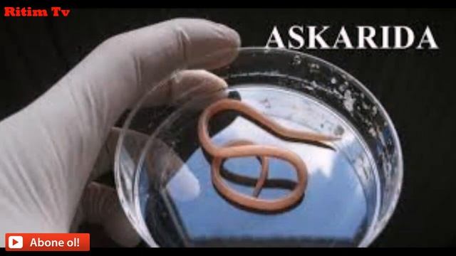 DİQQƏT!!!Uşaqlarda askarid qurdu haqqında (ən çox yayılan qurd növü) смотреть онлайн