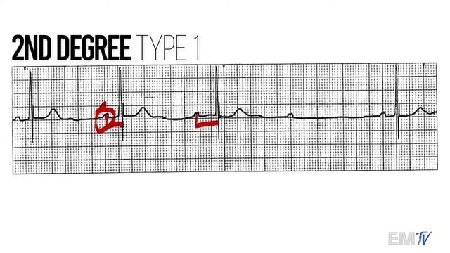 Static Cardiology: CARD 15 смотреть онлайн