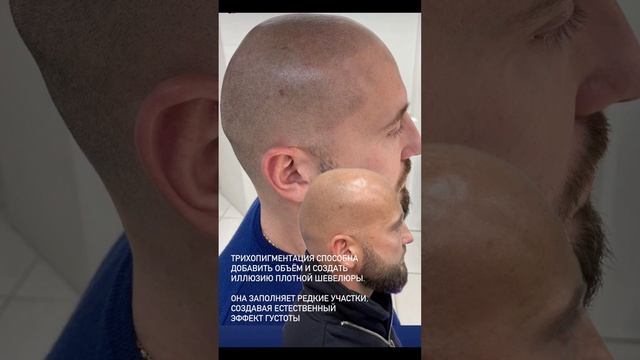Трихопигментация. Загущение волос и бороды. Эффект бритой головы. Маскировка шрамов на голове.
