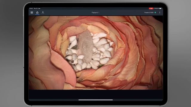 Using The ZEISS Connect App With ZEISS TIVATO 700