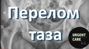 Перелом таза. Неотложная помощь
