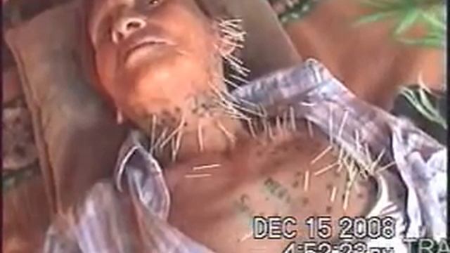 acupunture---05---- смотреть онлайн