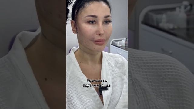 Через сутки после подтяжки лица смотреть онлайн