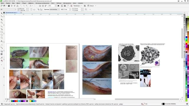 Онкологика - Грибковый след проблемы (23.11.2024)