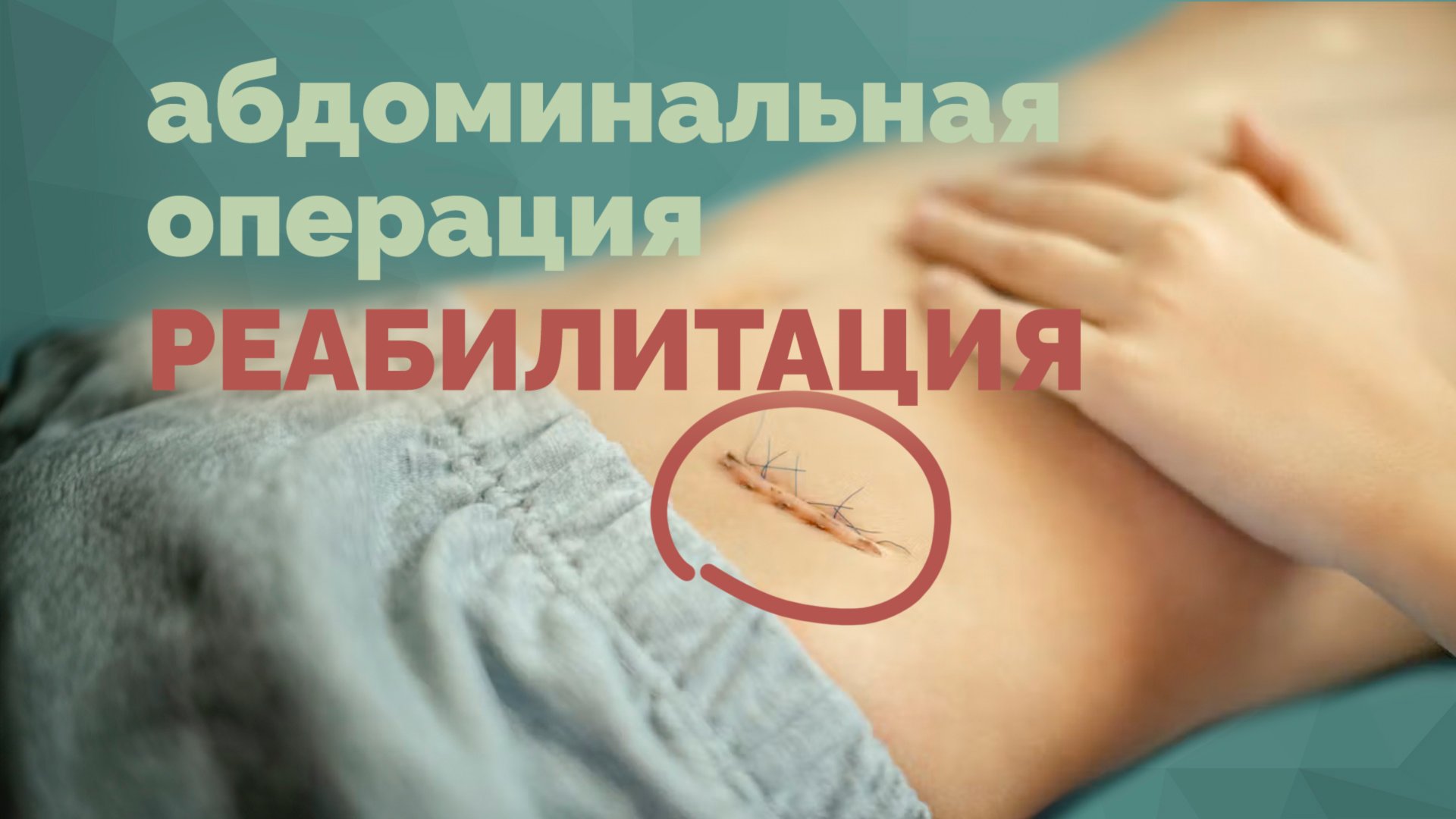 Реабилитация после Абдоминальных операций - упражнения смотреть онлайн