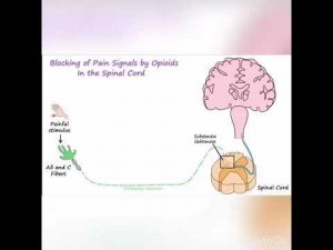 Опиоидные анальгетики
