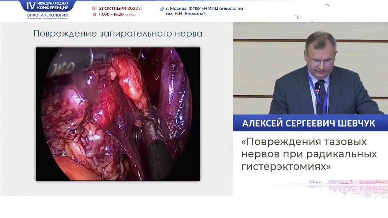 Повреждения тазовых нервов при радикальных гистерэктомиях. Шевчук А. С. смотреть онлайн