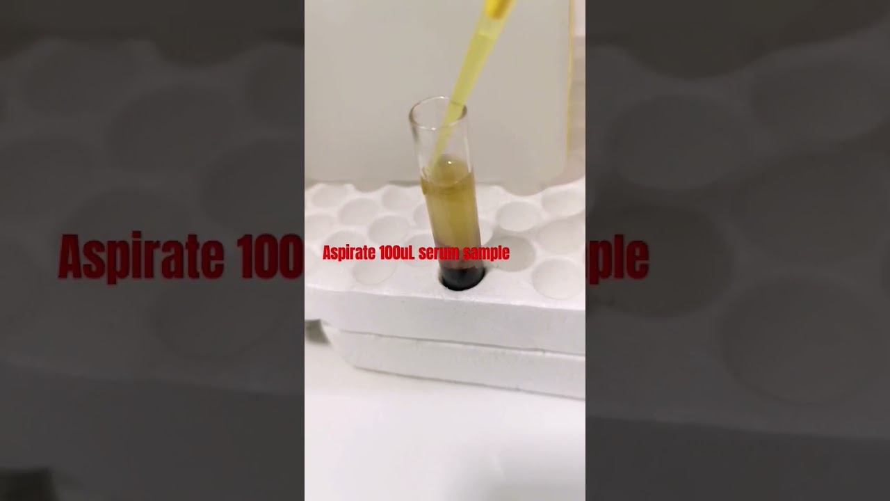 Hepa B Screening test #laboratory #medtechstudent #cls #mls #lab #serology #hepatitisb #hepab #bloo смотреть онлайн