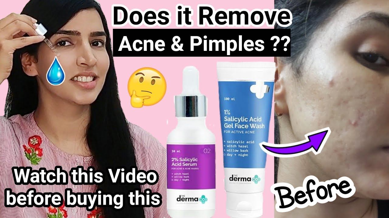 The Derma Co. 2% Salicylic Acid face serum & Face wash Review | Best serum for Acne pimples смотреть онлайн