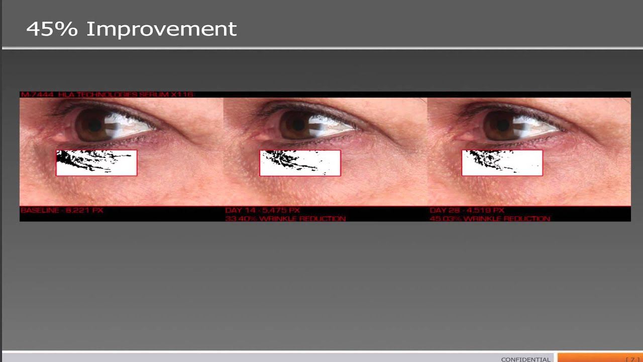 KANE NY: Serum Savant – Our Science and Results Explained смотреть онлайн
